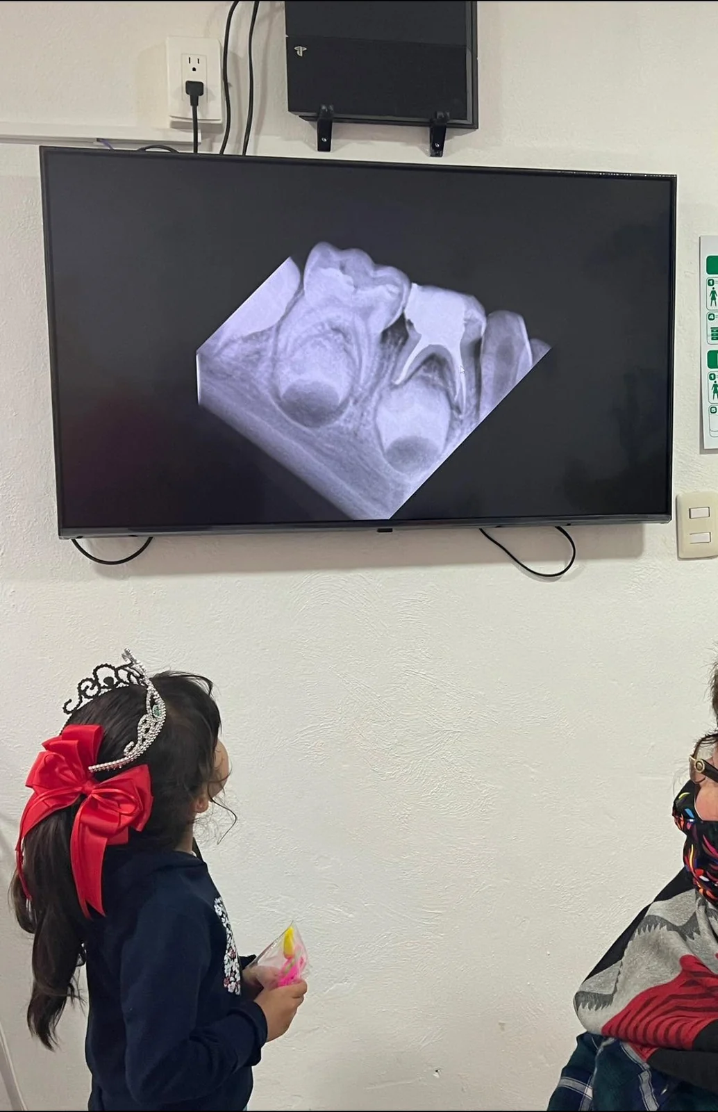 Explicación de un estudio dental en pantalla